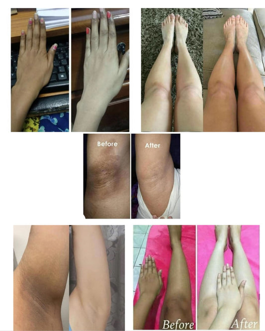 BODY WHITENING CREAM | Reduces dark spots, tanning, scars, dull skin