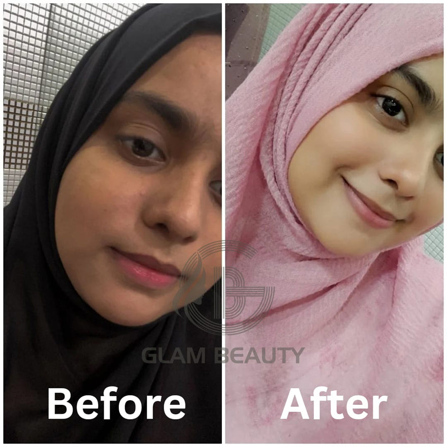 BRIDAL GLOWING NIGHT CREAM | 7 days results | Dullness Dark Spots Pigmentation correction | Ultimate Fairness & Glowing Skin | Brightening Skin